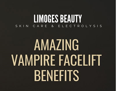Amazing Vampire Facelift Benefits You Need to Know