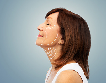 Facelift Surgery In Singapore