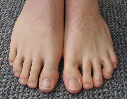 Silicone legs and partial feet