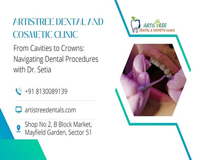 Navigating Dental Procedures with Dr. Setia