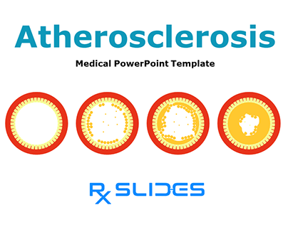 atherosclerosis PowerPoint Presentation Template