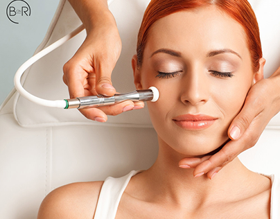 Microdermabrasion Services in Essendon Melbourne