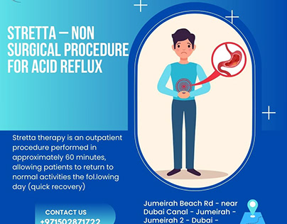 Stretta – Non Surgical Procedure For Acid Reflux