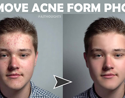 Remove Acne From Photo