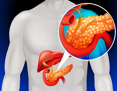 How to restore Pancreas to Work properly