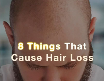 Things That Cause Hair Loss
