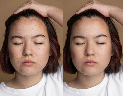 Removing skin blemishes in Photoshop