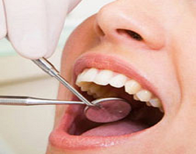 Questions to Ask During Root Canal Treatment