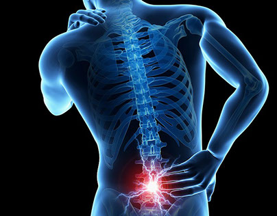 Naturopathy for Low Back Pain
