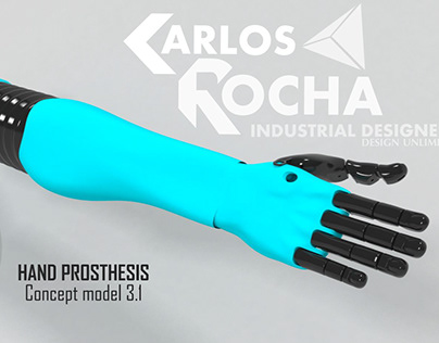 Diseño de prótesis- MYO Eléctrica