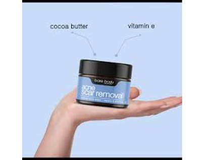 Best Cream For Acne Scars