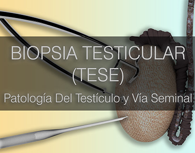 Biopsia (TESE) Patología Del Testículo y Vía Seminal