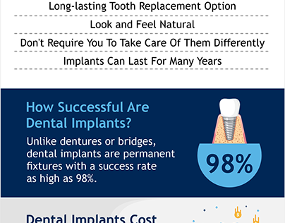 Dental Implant Everything You Need To Know