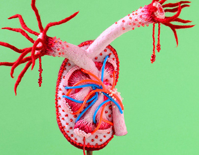 Anatomy of Kidney (腎臓標本)