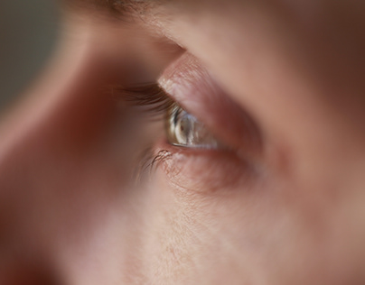 Retinal Detachment - A Severe Eye Problem