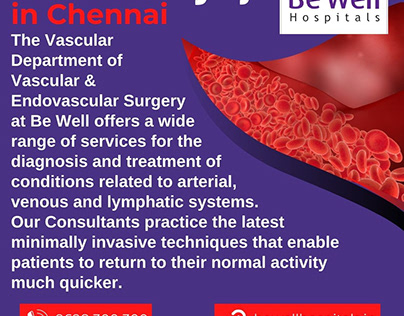 Vascular Surgery in Chennai