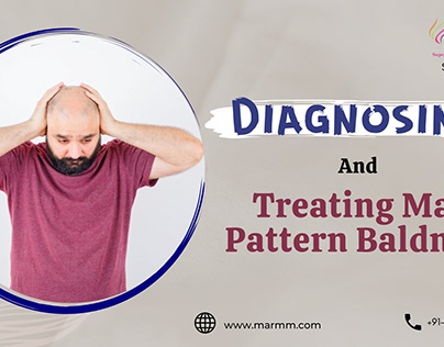 Diagnosing And Treating Male Pattern Baldness