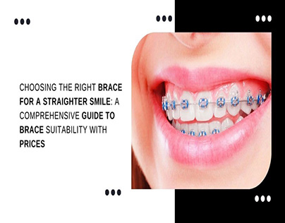 Choosing the Right Brace for a Straighter Smile
