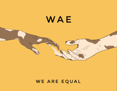 WAE - we are equal