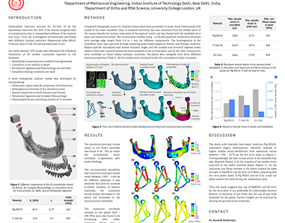 Jaw fracture biomechanics ORS 2023 Poster
