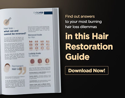 Hair Restoration Guide