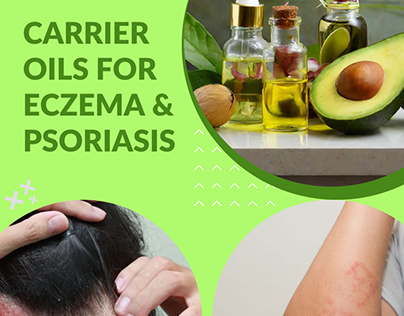 Best Carrier Oils for Relief of Eczema and Psoriasis