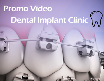 Promo Video For Dental Implant Clinic