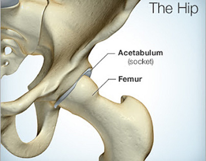 Why hip pain occurs