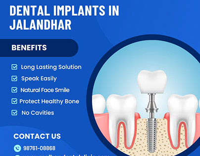Dental Implants in Jalandhar Malhan Dental Clinic
