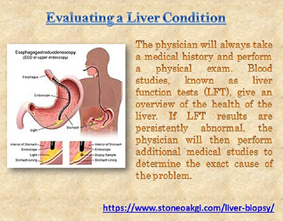 Evaluating a Liver Condition