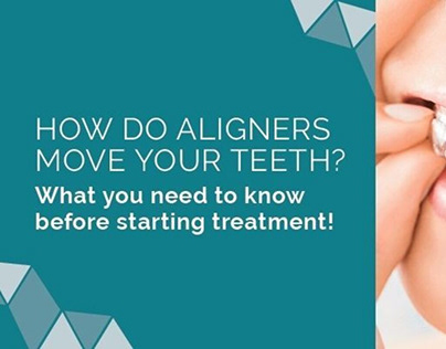 Transform Your Smile with Clear Aligners