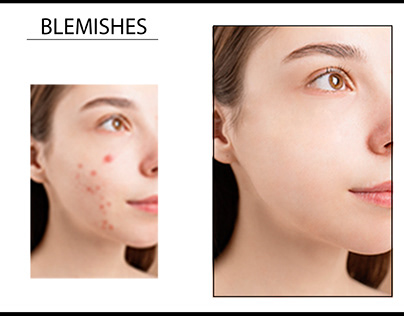 Blemishes removal in photoshop