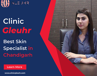 Best Skin Specialist in Chandigarh
