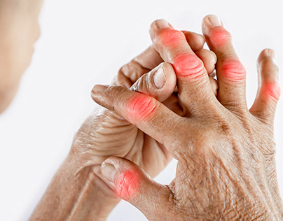 Treating the Root Cause of Arthritis Through TCM