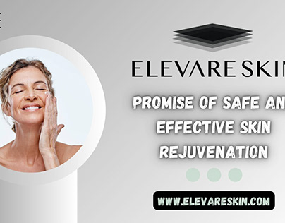 Elevare Skin's Promise of Safe Skin Rejuvenation
