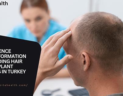 Leading Hair Transplant Clinics in Turkey