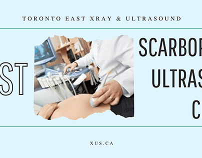 Best Scarborough Ultrasound Clinic | XUS CANADA