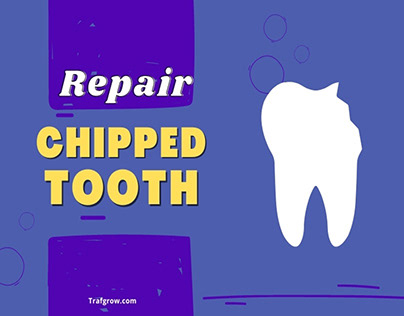 Chipped Tooth Problems Solved with These Orthodontic