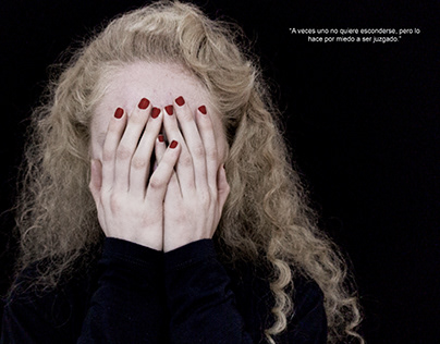 Revista | La oscuridad del Albinismo