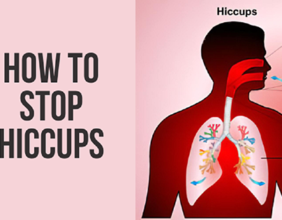 How to stops hiccups