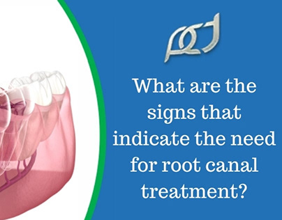 Signs that indicate the need for root canal treatment