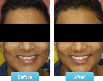 Best Dentist In Mumbai | Smile again