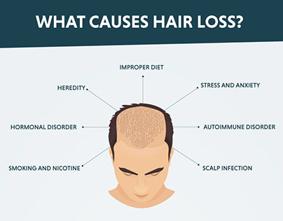 Hair Loss Infographic