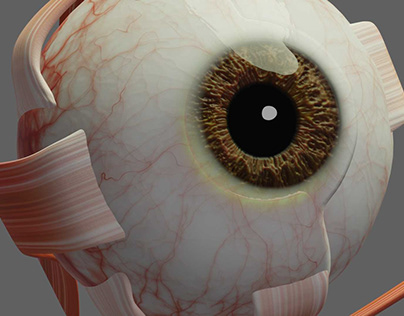 OPERATION OF THE PUPIL WITH THE IRIS