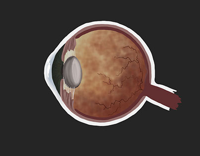Cross Section of the Eye