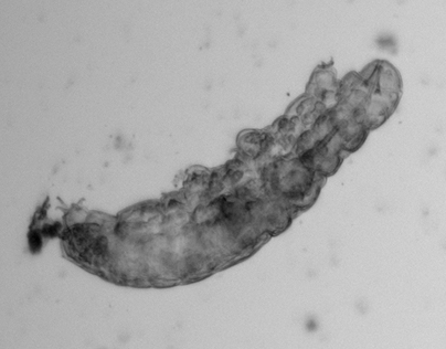 Tardigrade Microscope Videos