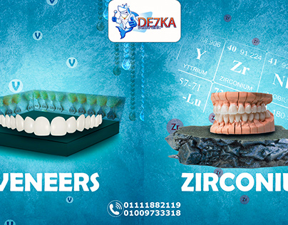 dental veneer and zirconium