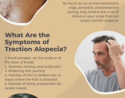 How We Reverse Traction Alopecia