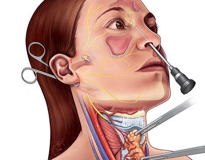 Otolaryngology Textbook Cover Illustration