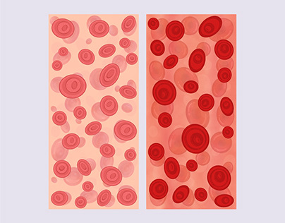 Project thumbnail - Red blood cells